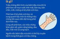 Hướng dẫn chẩn đoán, điều trị và phòng bệnh đậu mùa khỉ ở người