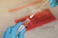 Chủ động tổ chức thực hiện việc test nhanh kháng nguyên SARS-COV-2 đối với cán bộ, công chức, viên chức, người lao động với tần suất 03 ngày/lần