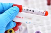 Chủ trương mới về xét nghiệm SAR-CoV2