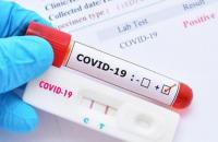 Phong tỏa toàn địa bàn đối với các xã, phường, thị trấn có nguy cơ rất cao (cấp độ 4)